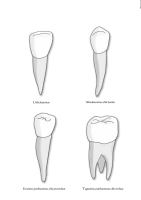 Poster: Erinevad hambatüübid