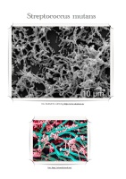 Poster: Streprococcus mutans