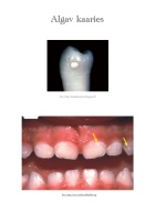 Poster: Kaaries Poster: Kaaries